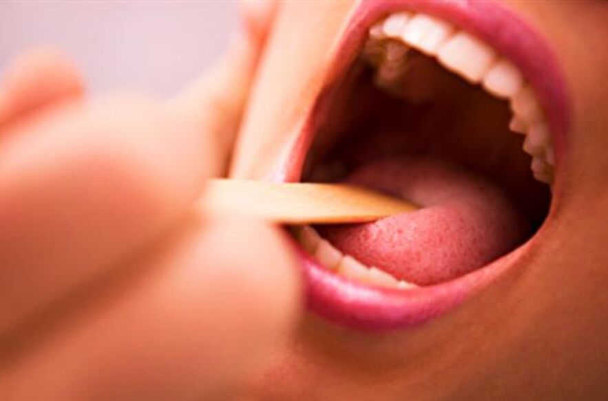 адам аузындағы паразиттердің түрлері